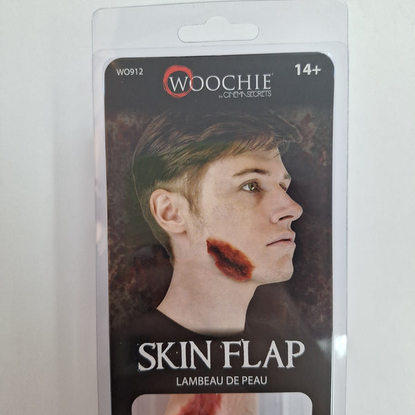 Skin Flap