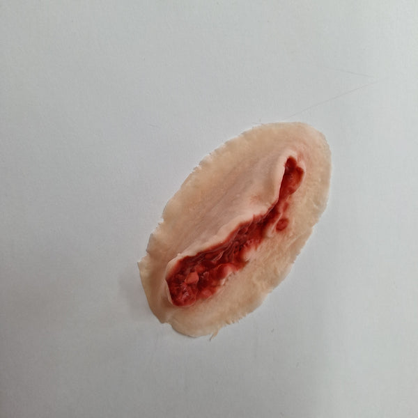 Colgajo de piel